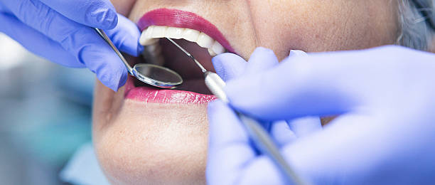 Best Emergency Dental Care for Broken or Chipped Teeth in Valley Falls, SC